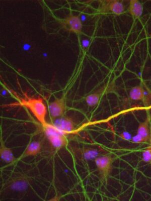 Neurones - IGBMC, Moine Hervé